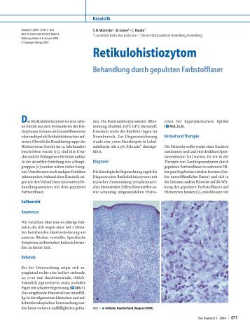 Retikulohistiozytom. Behandlung durch gepulsten Farbstofflaser