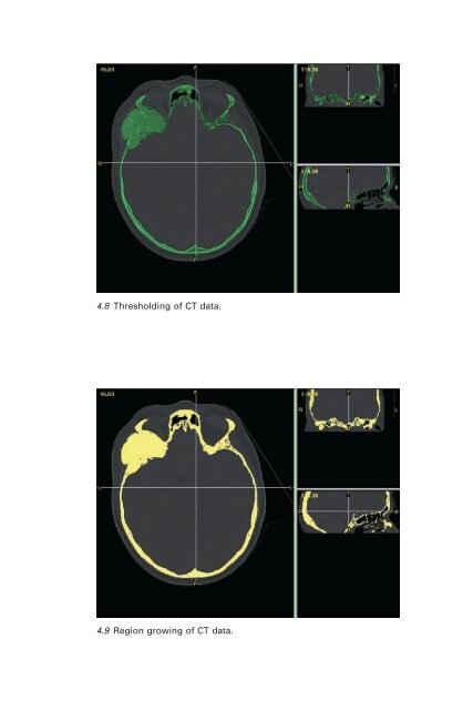 R_Bibb_Medical_Modelling_The_Application_of_Adv.pdf