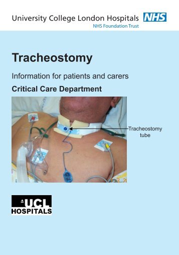Tracheostomy - University College London Hospitals NHS Trust