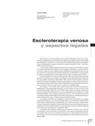Escleroterapia venosa y aspectos legales - Mundo Flebológico ...