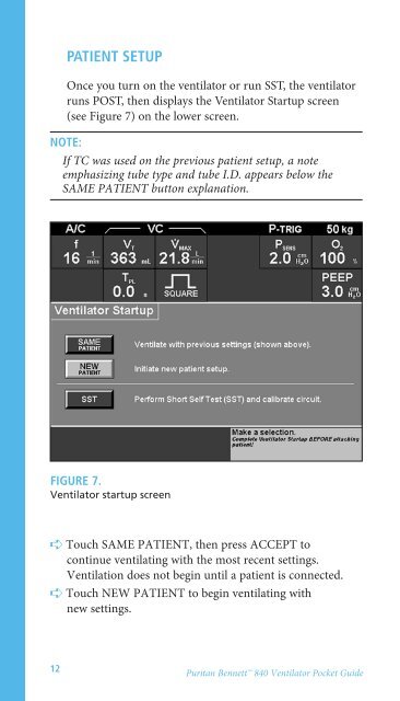 Puritan Bennett™ 840 Ventilator User's Pocket Guide - Covidien