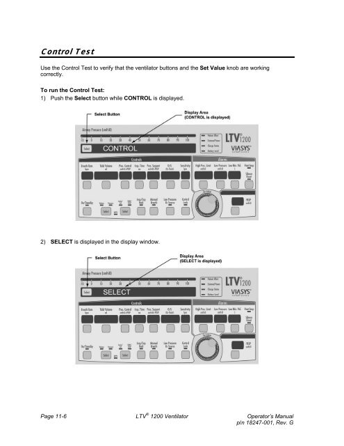 LTV 1200 Operator's Manual - CareFusion Emergency Preparedness