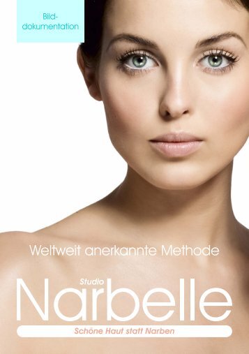 Narbelle Broschüre - Hautarztpraxis Dr. med. <b>Urs Sigrist</b> - narbelle-broschure-hautarztpraxis-dr-med-urs-sigrist