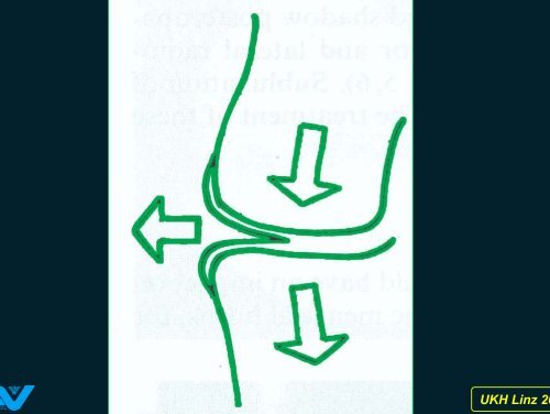 Zum Verständnis der Pathologie von ... - Fischmeister