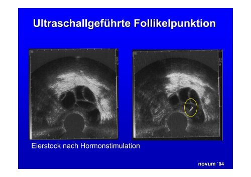 novum `04 - Zentrum für Reproduktionsmedizin