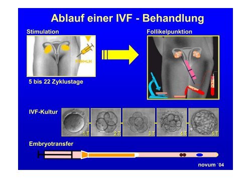 novum `04 - Zentrum für Reproduktionsmedizin