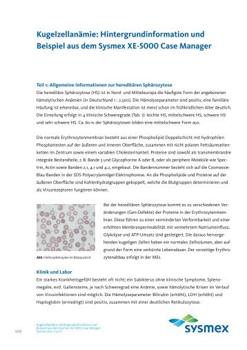 Kugelzellanämie - Sysmex Deutschland GmbH