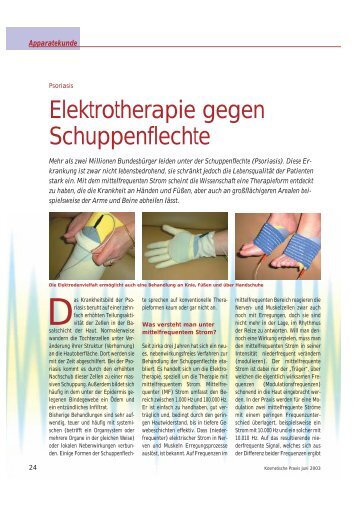 Elektrotherapie gegen Schuppenflechte - Ionto-Comed GmbH