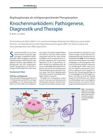 Vollständiger Artikel - Osteoporose Zentrum Prof. Reiner Bartl