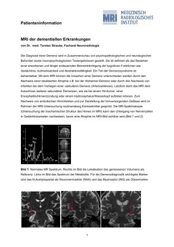 Patienteninformation MRI Demenz