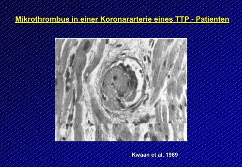 TTP / HUS – Symptomen-Trias TTP Blutungen (Thrombozytopenie ...