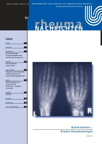 Kinder-Rheumatologie - Rheuma Schweiz