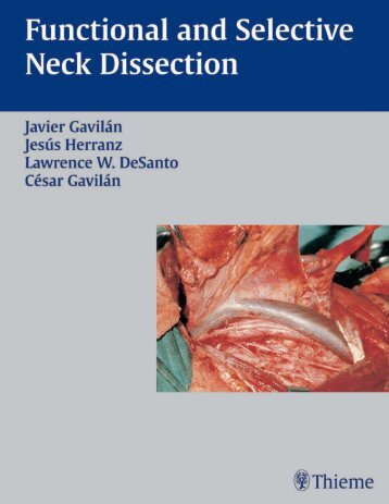 Functional and Selective Neck Dissection.pdf - E-Lib FK UWKS
