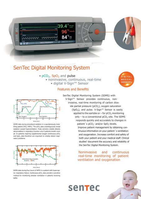SenTec Digital Monitoring System (English) - SenTec AG