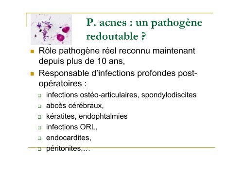 Un germe émergent - P acnes - ARLIN de Lorraine