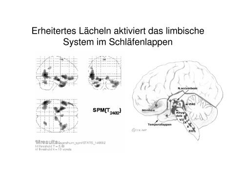 Neurophysiologie des Lächelns und Lachens (pdf)