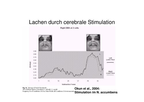 Neurophysiologie des Lächelns und Lachens (pdf)