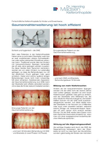 Download (.pdf, 508 KB) - Dr. Madsen, Kieferorthopäde