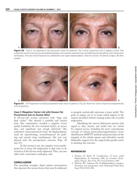 Comprehensive Lower Eyelid Rejuvenation - Dr. Guy Massry