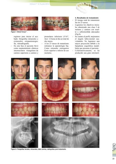 Artículo Innova - Ortodoncia Novasmile