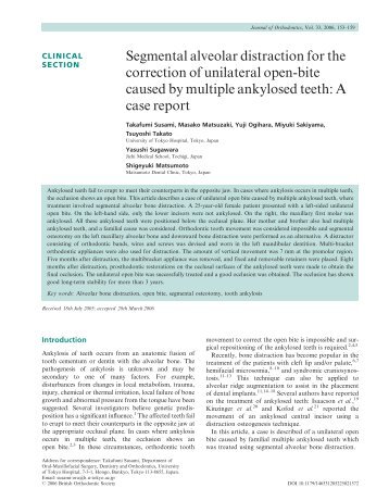 Segmental alveolar distraction for the correction of unilateral open ...