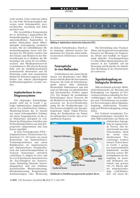 Mikrotechnik in der Medizin