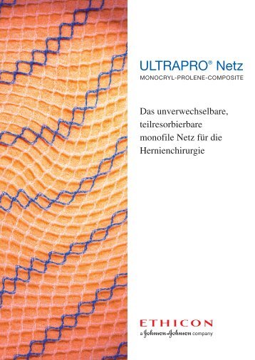 ULTRAPRO® Netz - Ethicon