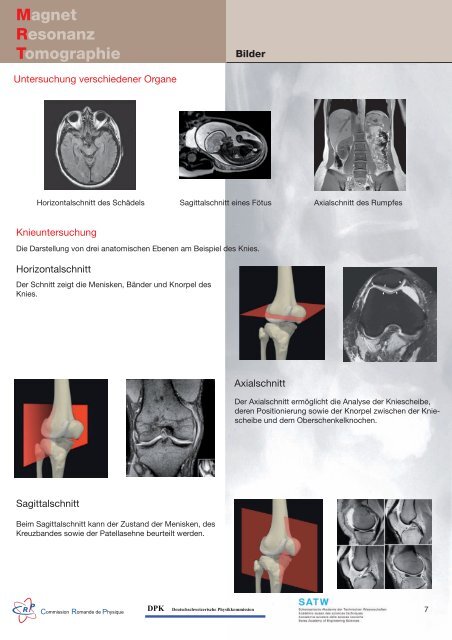 Sonografie Ultraschall- untersuchung