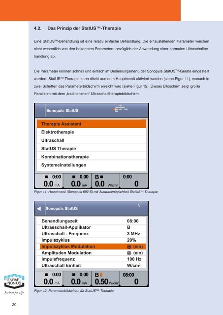 ENRAF NONIUS SONOPULS StatUS - Medizintechnik Schlechte