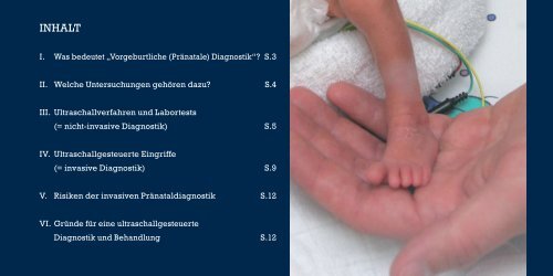 Flyer Praenataldiagnostik RZ - Die Mathias Stiftung