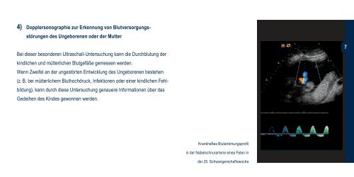 Flyer Praenataldiagnostik RZ - Die Mathias Stiftung