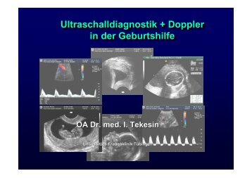 Ultraschalldiagnostik + Doppler in der Geburtshilfe ...