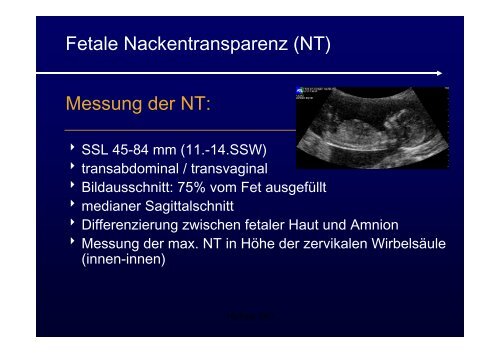 Ultraschalldiagnostik + Doppler in der Geburtshilfe ...