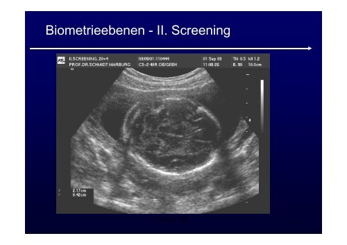 Ultraschalldiagnostik + Doppler in der Geburtshilfe ...