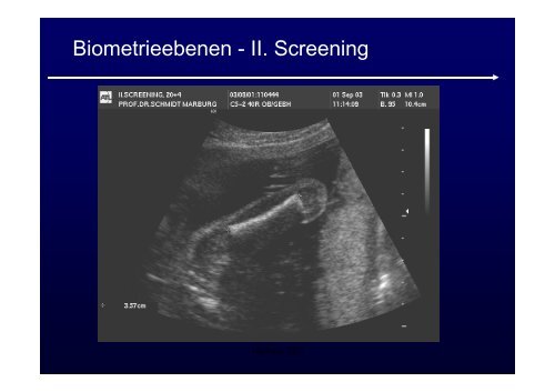 Ultraschalldiagnostik + Doppler in der Geburtshilfe ...