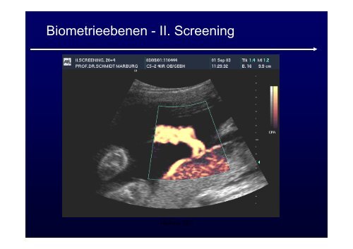 Ultraschalldiagnostik + Doppler in der Geburtshilfe ...