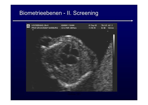 Ultraschalldiagnostik + Doppler in der Geburtshilfe ...