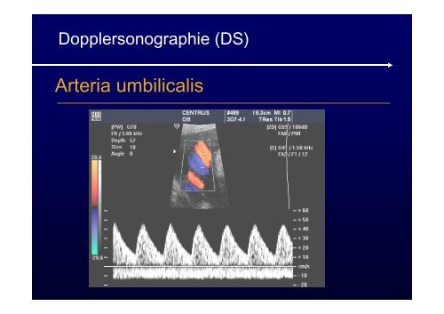 Ultraschalldiagnostik + Doppler in der Geburtshilfe ...
