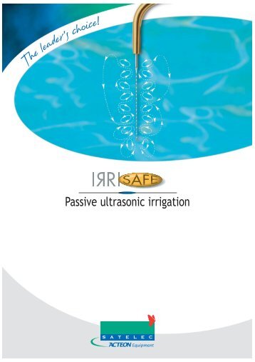 Passive ultrasonic irrigation - The EndoExperience