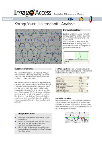 Bildanalyse - Korngrösse/Linienschnitt - Imagic Bildverarbeitung AG