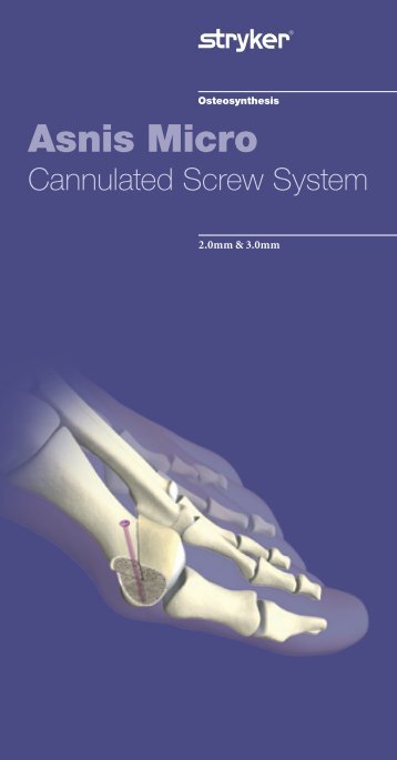 stryker osteosynthesis selzach adresse Ch-2545 selzach switzerland wwwosteosynthesisstrykercom the information presented in this brochure is intended to demonstrate a stryker product always refer. stryker osteosynthesis selzach adresse Ch-2545 selzach switzerland wwwosteosynthesisstrykercom the information presented in this brochure is intended to demonstrate a stryker product always refer.