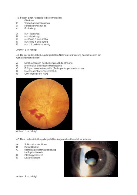 100Fragen Augenheilkunde WS 2003