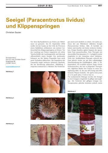 Seeigel (Paracentrotus lividus) und Klippenspringen - Swiss ...