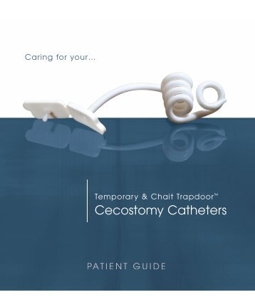 Cecostomy Catheters - Cook Medical