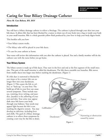 Caring for Your Biliary Drainage Catheter - Memorial Sloan ...