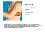 Bedbug bites Dermatitis herpetiformis Ecthyma Guttate ... - MDC