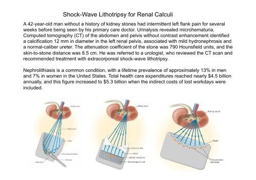 Beckwith-Wiedemann syndrome Hypoglossal nerve injury ... - MDC