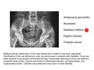 Anklylosing spondylitis Ascariasis Diabetes mellitus Paget's ... - MDC