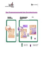 Das Progressionsmodell des Zervixkarzinoms