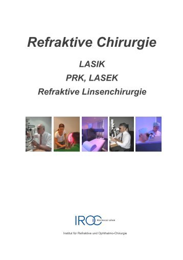 LASIK V5 - IROC :. Institut für Refraktive und Ophthalmo-Chirurgie